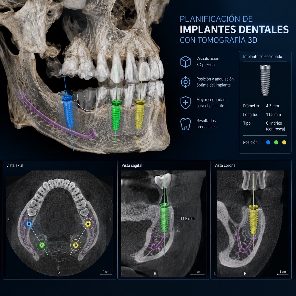Radiografía 3D para planificación dental